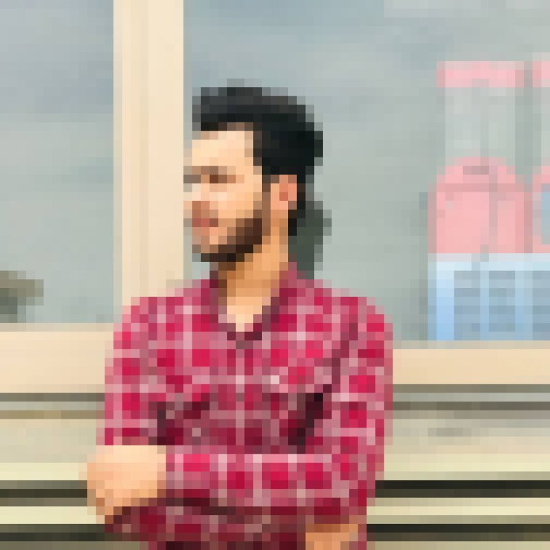 Abbas, 27, Albino